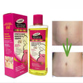 Stretch mark removed and firming Oil